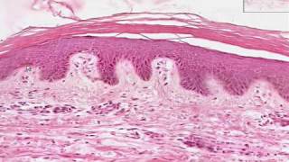 Shotgun Histology Thin Skin [upl. by Mcafee]