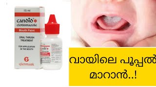 Clotrimazole mouth paint Malayalam review  candid mouth paint  വായിലെ പൂപ്പൽ മാറാൻ  antifungal [upl. by Cathryn224]