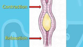 Diseases of the esophagus part 1 by ASM Minds [upl. by Liw]