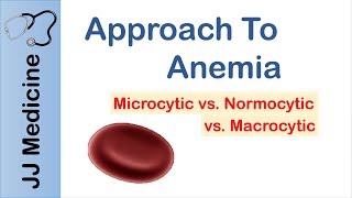 Anemia  Microcytic vs Normocytic vs Macrocytic [upl. by Bezanson875]