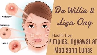 Pimples Tigyawat at Mabisang Lunas – by Doc Katty Go Dermatologist 33 [upl. by Lontson]