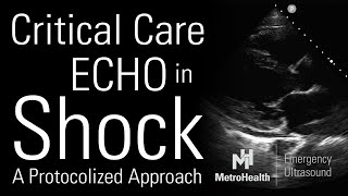 Critical Care Echocardiography in Shock [upl. by Irwinn213]