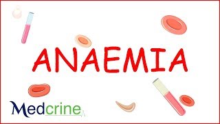 Anemia  causes classification clinical features treatment [upl. by Shushan]