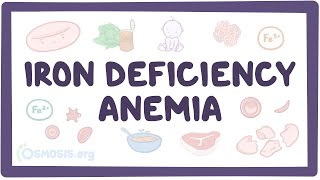 Iron deficiency anemia  an Osmosis Preview [upl. by Ednyl198]