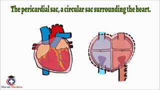 Cardiac Tamponade Pulsus Paradoxus [upl. by Nosyrb]