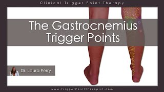 The Gastrocnemius Trigger Points [upl. by Peursem]