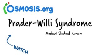 PraderWilli Syndrome  CRASH Medical Review Series [upl. by Rochus807]