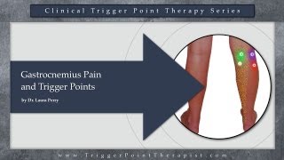 Gastrocnemius Pain and Trigger Points [upl. by Hasen]