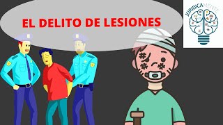 EL DELITO DE LESIONES [upl. by Bixby]