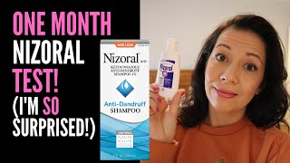 HAIR LOSS SUFFERER REVIEWS NIZORAL SHAMPOO One Month Review On 2 Ketoconazole IM VERY SURPRISED [upl. by Henryetta159]