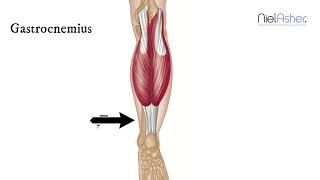 How To Find Trigger Points  Gastrocnemius [upl. by Nakada570]