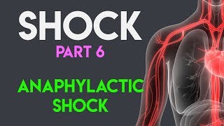 Anaphylactic Shock  Shock Part 6 [upl. by Lida]