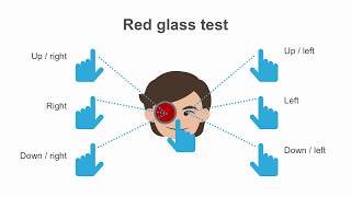 Convergence amp Divergence Eye Exercise 1 Trinity Eye Care [upl. by Armin]