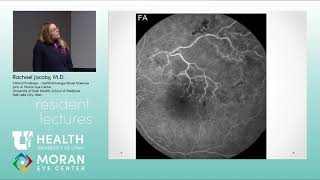 Retinal Vascular Disease Part 1 of 2 [upl. by Denice]