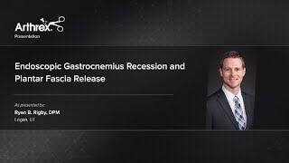 Endoscopic Gastrocnemius Recession and Plantar Fascia Release [upl. by Ahseyi]