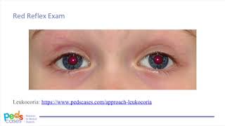 Pediatric Eye Exam [upl. by Iaverne]