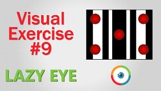 Lazy Eye Exercise 09 [upl. by Stagg]