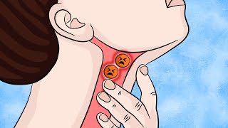 Swallowing Problems Heres how to Fix it Naturally [upl. by Care190]