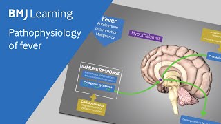 Pathophysiology of fever explained [upl. by Bronwen]