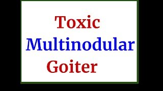 Toxic Multinodular Goiter [upl. by Petronella423]