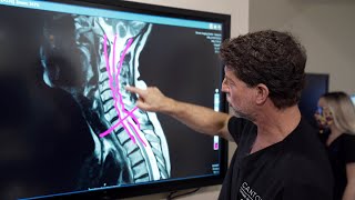 Symptoms of Cervical Stenosis  Jeffrey Cantor MD [upl. by Christoper765]