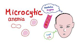 Microcytic Anemia introduction [upl. by Ermin326]