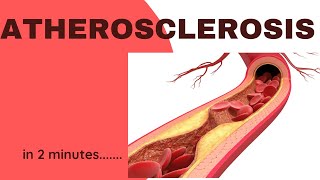 Arteriosclerosis Atherosclerosis Arteriolosclerosis Detalied Pathology Lecture [upl. by Ahsym468]