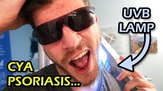 Psoriasis UVB Light Treatment From Home  Vlog 3 [upl. by Kado]