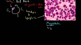 Macrocytic Anemia [upl. by Keefer]