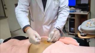 UltrasoundGuided Sacroiliac Joint Injection Technique [upl. by Soph232]