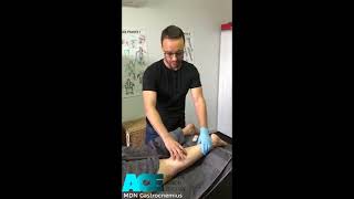 Myofascial Dry Needling of the Gastrocnemius [upl. by Nevins]