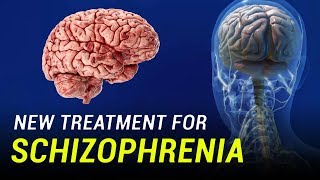 New Treatment for Schizophrenia [upl. by Asuncion]