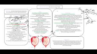 placental abruption [upl. by Ecirpac]