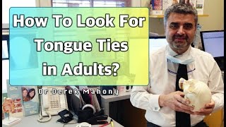 How To Look For Tongue Ties In Adults [upl. by Acyssej]