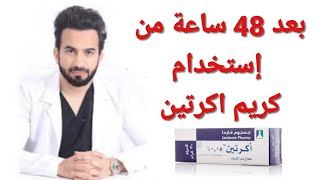 طريقة استخدام اكرتين لعلاج حب الشباب Acretin cream دكتور طلال المحيسن [upl. by Moriah]