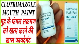 Nuforce Mouth Paint Benefits।Clotrimazole Mouth Paint।Oral Fungul Infection।छाले व सफेद फफूंद [upl. by Dedrick]