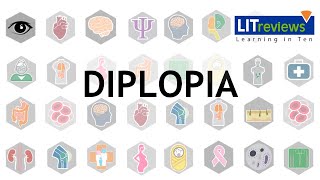 Diplopia [upl. by Annaynek]