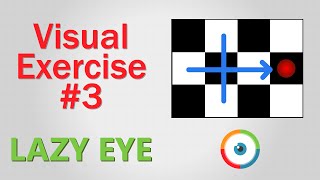 Lazy Eye Exercise 03 [upl. by Eselrahc]