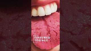 Warning Signs From Your Tongue [upl. by Ferdie]