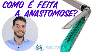 Como é feita a anastomose de intestino [upl. by Jaclyn101]