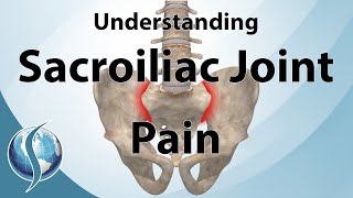 Understanding Sacroiliac Joint Pain [upl. by Nagud951]