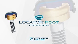 LOCATOR® Root Attachment System [upl. by Htebzil]