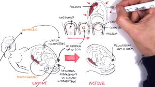 Obstetrics  Stages of Labour [upl. by Ytineres]